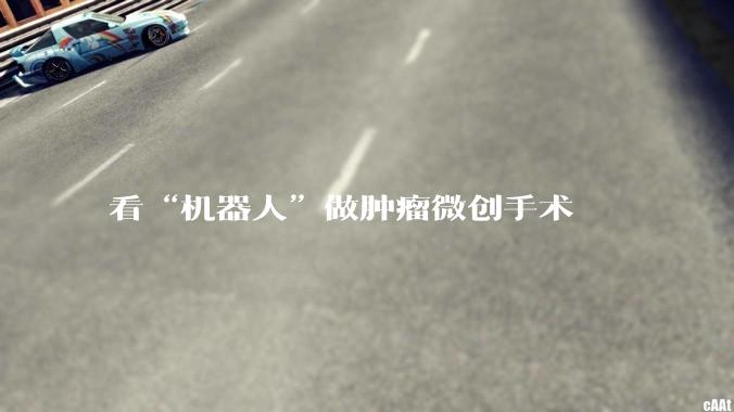 看“机器人”做肿瘤微创手术